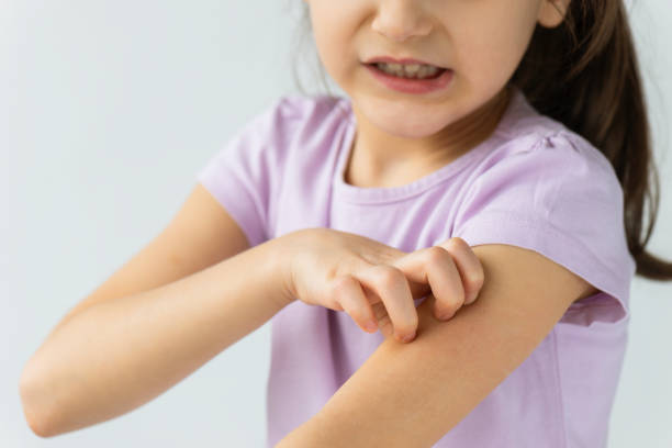 girl crawling after mosquito bite