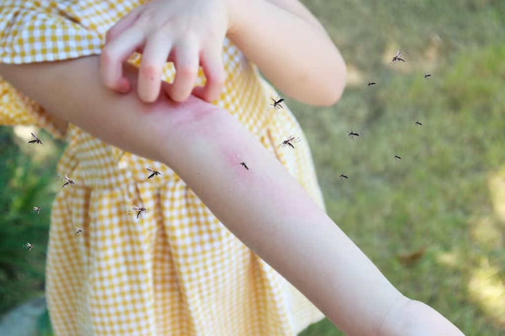 pequeña niña propensa a la picadura de mosquitos